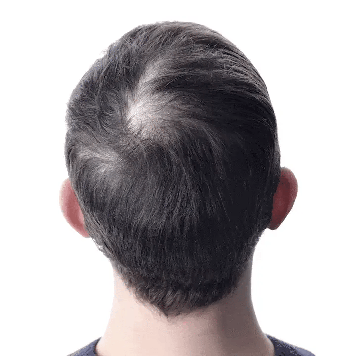 RootLab™: Tratamiento que detiene la caída desde la raíz